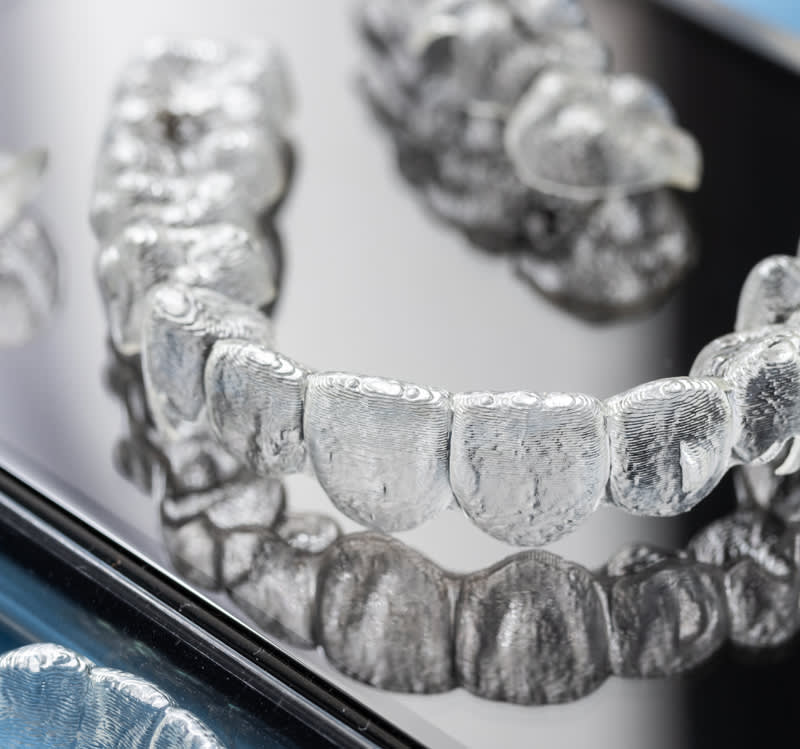 About Invisalign | Ottawa Dentist